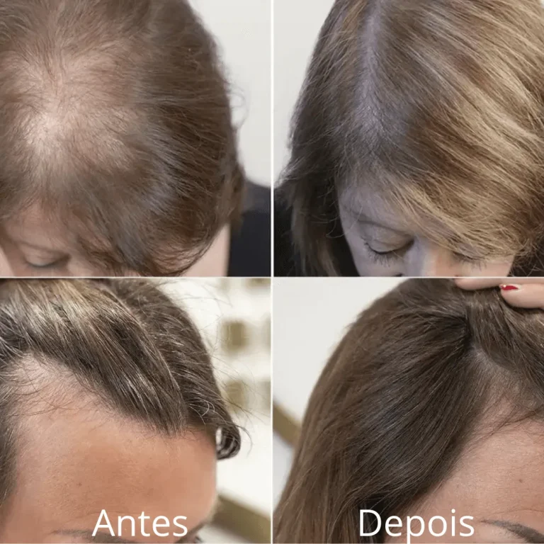Antes-1